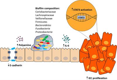 A tale of two bacteria – Bacteroides fragilis, Escherichia coli, and colorectal cancer